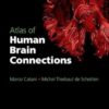 Atlas of Human Brain Connections