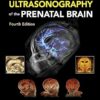 Timor's Ultrasonography of the Prenatal Brain 4th Edition